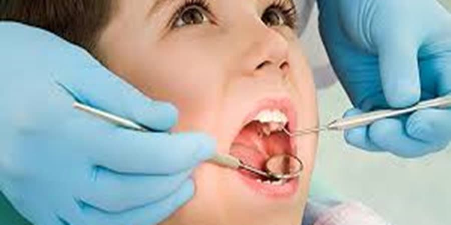 بیمه سلامت کدام خدمات دندانپزشکی را پوشش می‌دهد